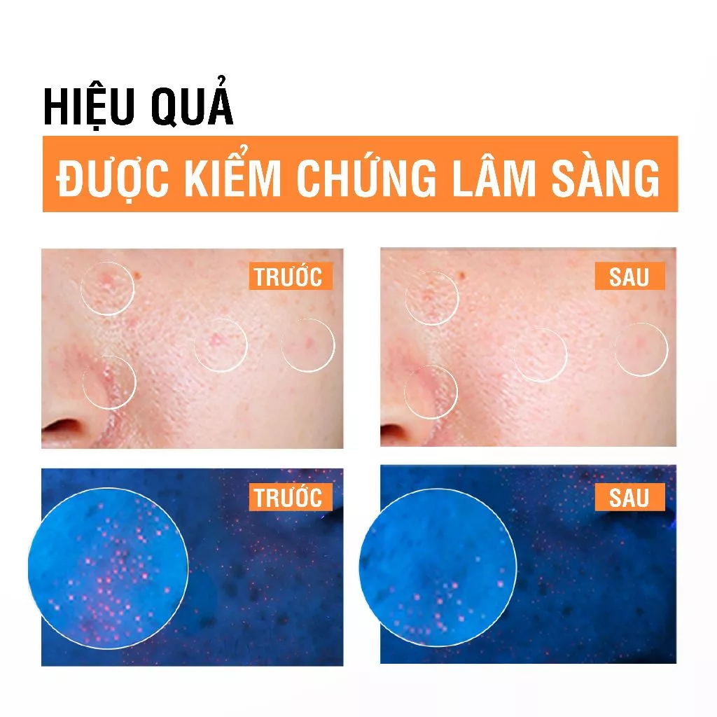  Sữa Rửa Mặt Neutrogena Sạch Sâu cho Da Nhạy Cảm - Deep Clean Facial Gel Cleanser (150ml) 