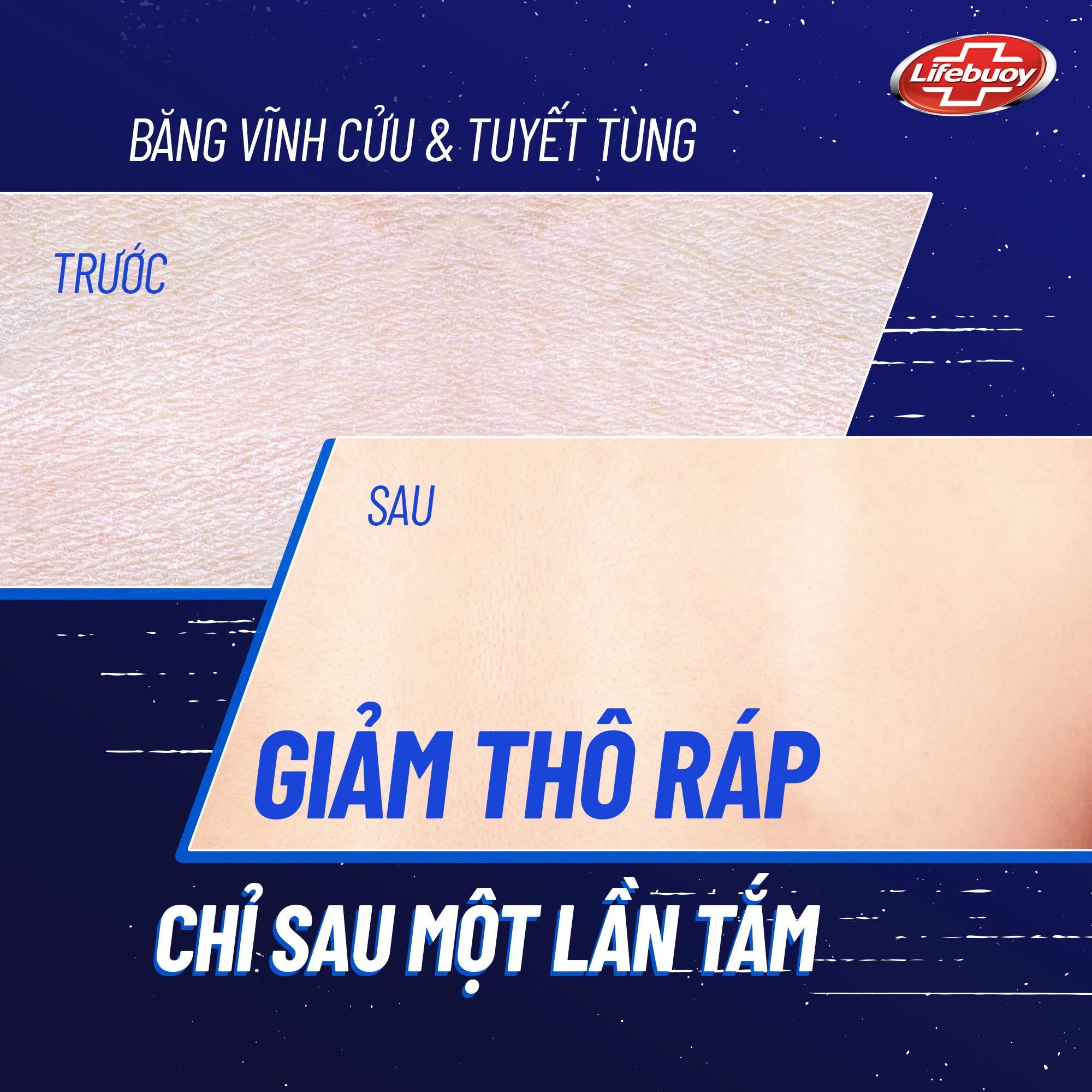  Sữa Tắm Lifebuoy 800gr Detox Và Sạch Sâu Khỏi Bụi Mịn Pm2.5 Detox 100% Từ Thiên Nhiên Diệt Khuẩn 