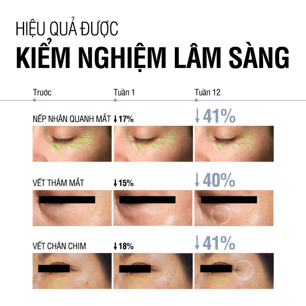  Kem mắt Retinol Chống Lão Hóa Giảm Nhăn Neutrogena Visible Repair Eye Cream (15g) 