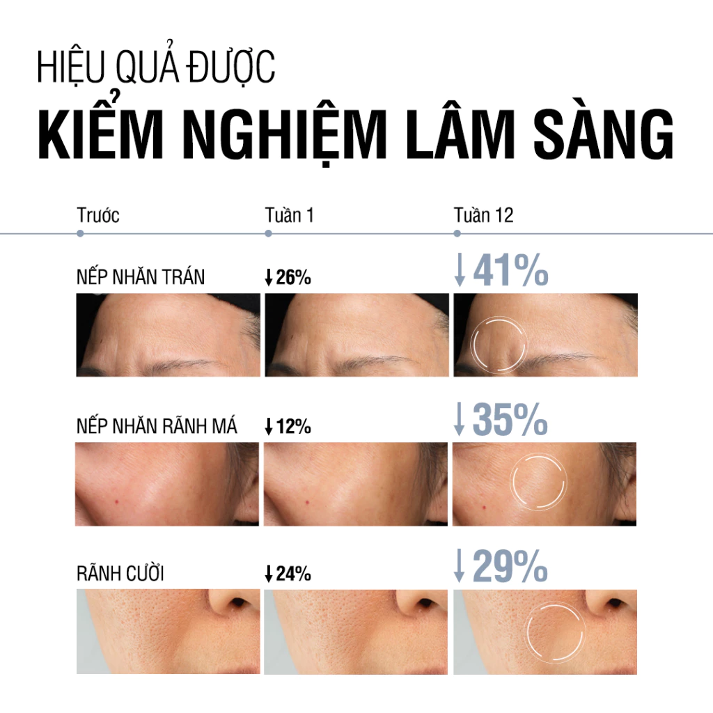  Serum Retinol Chống Lão Hóa Giảm Nhăn Neutrogena® Visible Repair Serum (30ml) 
