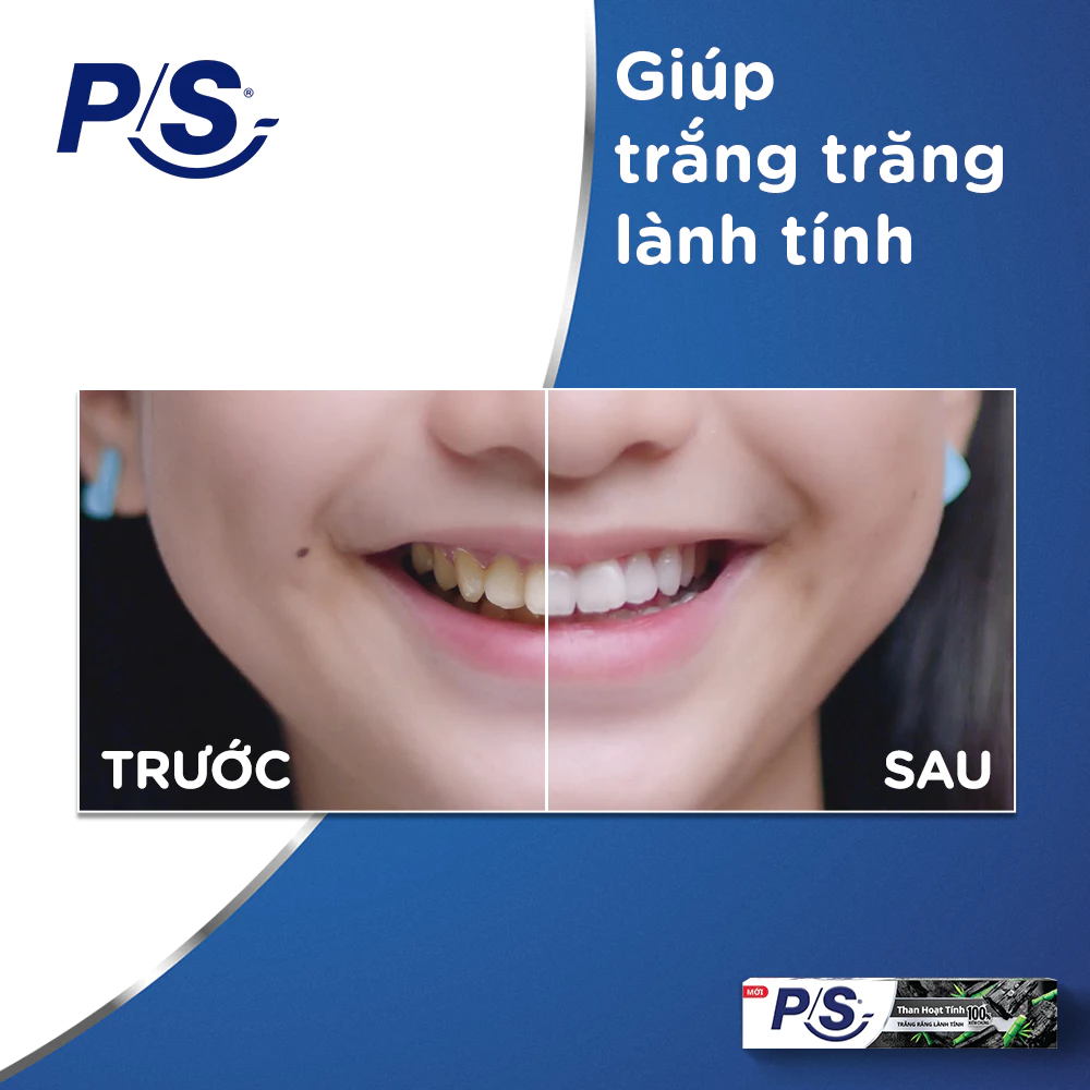  Kem đánh P/S Răng Trắng Lành Tính - 100% Kiểm Chứng 230g 