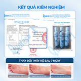  Bình xịt ngăn mùi hôi chân XIMO Feet Spray Xịt khử mùi thơm chân hạn chế vi khuẩn và lưu giữ mùi hương cho lòng bàn chân 