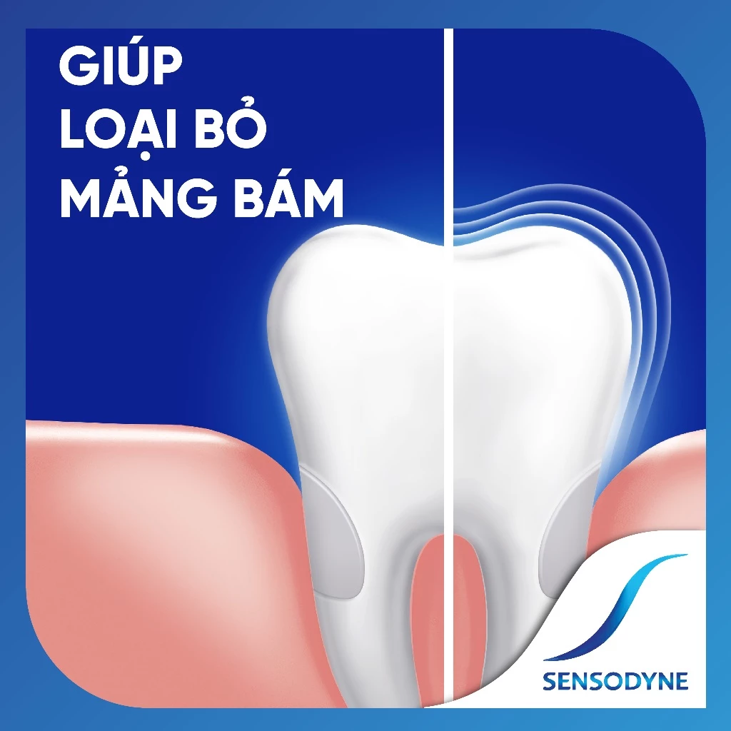  Kem đánh răng SENSODYNE Deep Clean 160g giúp giảm ê buốt hiệu quả, sạch sâu cho hơi thở thơm mát 