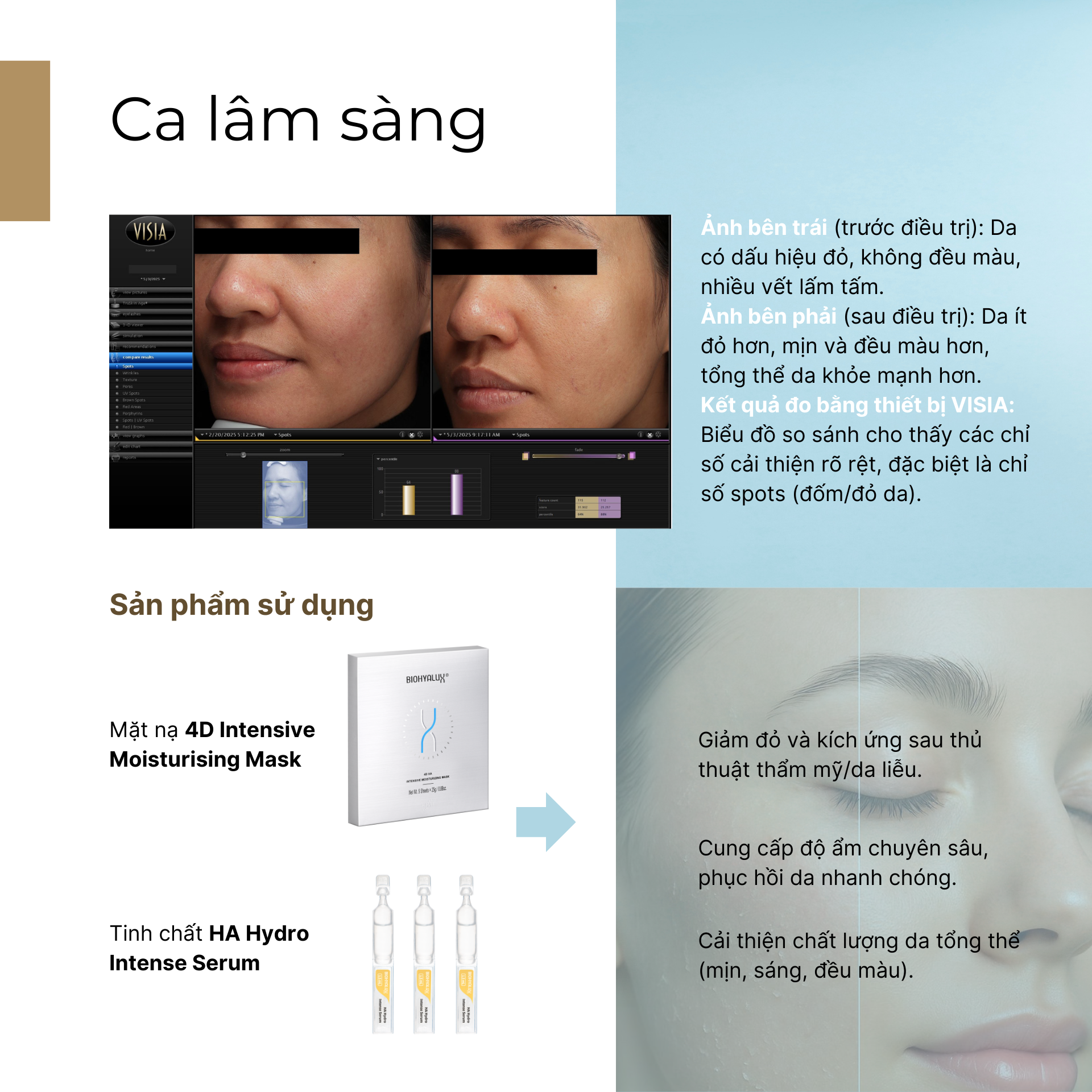  HA HYDRO INTENSE SERUM - CẤP ẨM CHUYÊN SÂU, DƯỠNG ẨM KÉO DÀI 