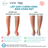  Lót Giày Chỉnh Hình Bàn Chân Bẹt 