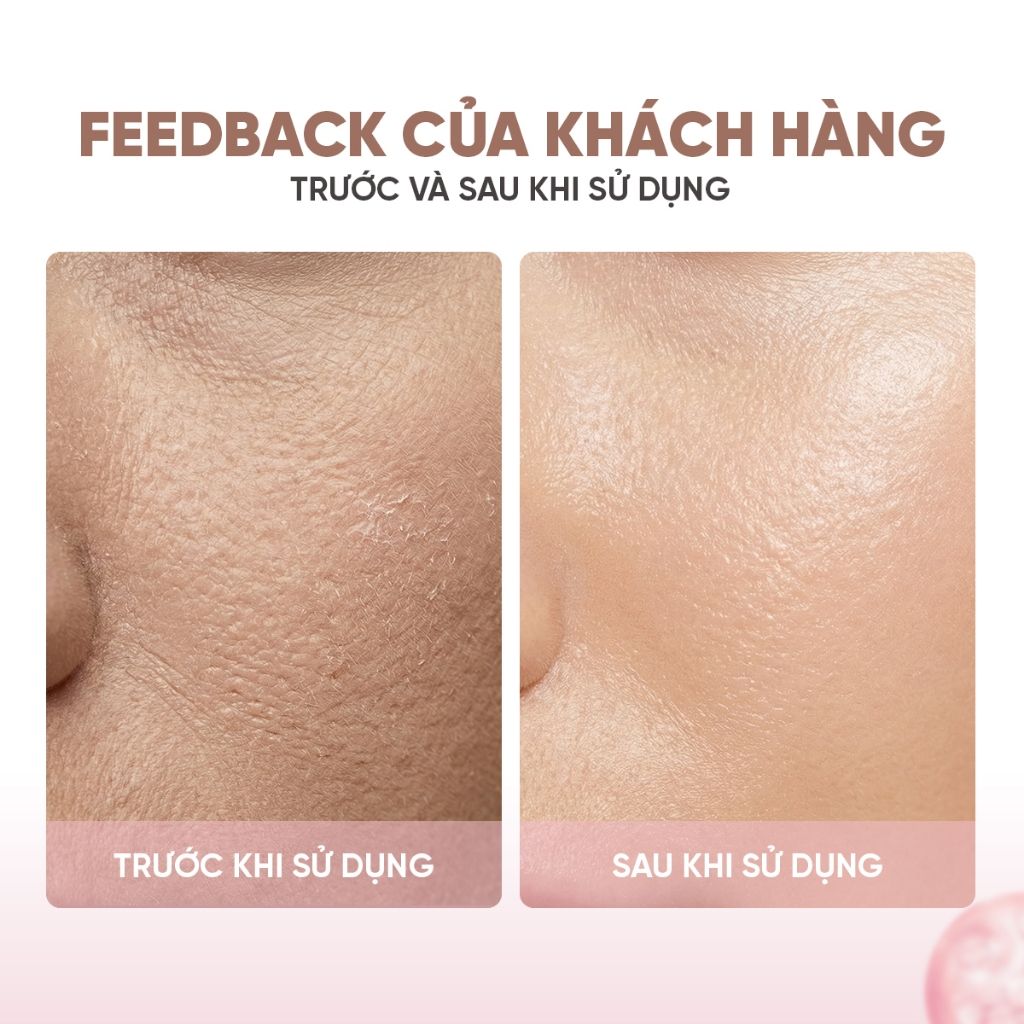 Kem Dưỡng Ẩm Dưỡng Sáng Da ÉTÉ Beauté Moist Cream Chống Lão Hóa Và Làm Đều Màu Da, Thành Phần Thiên Nhiên 30g