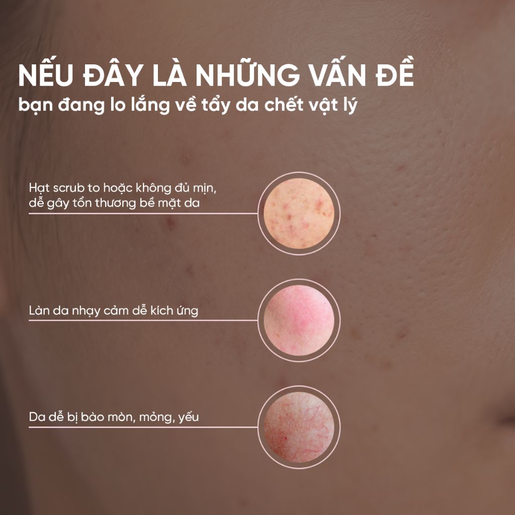 Gel Tẩy Da Chết Mặt Dịu Nhẹ, Loại Bỏ Lớp Sừng & Bã Nhờn, Giúp Da Sáng Mịn, Đều Màu ÉTÉ Peeling Gel 120g