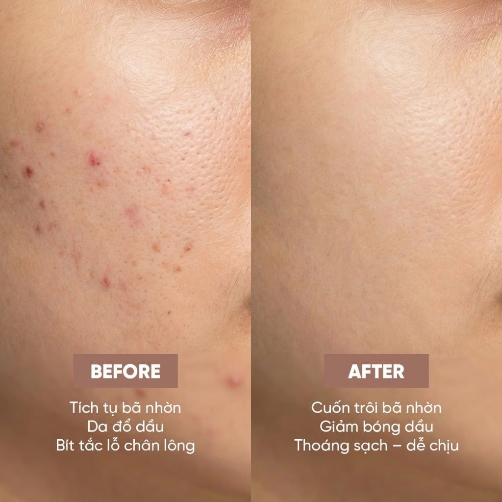 Sữa Rửa Mặt Làm Sạch Sâu Été Beauté Face Wash Nhật Bản Sữa Rửa Mặt Mờ Thâm Sáng Khoẻ, Dưỡng Da Mềm Mịn 130g