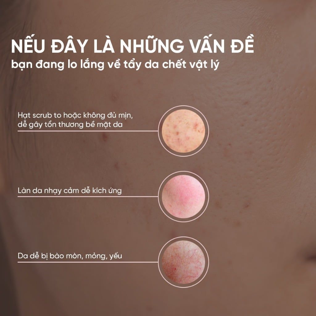 Gel Tẩy Da Chết Mặt Loại Bỏ Lớp Sừng & Bã Nhờn, Giúp Da Sáng Mịn, Đều Màu ÉTÉ Peeling Gel 120g