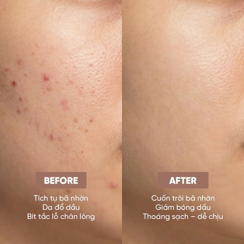 Sữa Rửa Mặt Làm Sạch Sâu Été Beauté Face Wash Nhật Bản Sữa Rửa Mặt Dưỡng Da Mềm Mịn, Mờ Thâm Sáng Khoẻ 130g