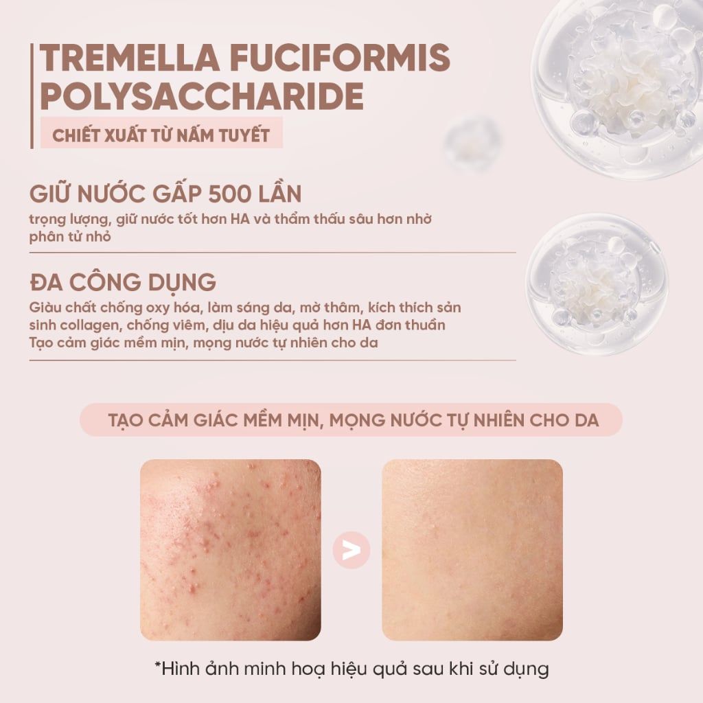Tinh Chất Serum Làm Sáng Và Chống Lão Hoá Été Beauté Moist Serum 50ml Hỗ Trợ Trắng Da, Căng Bóng, Phục Hồi Da, Mờ Thâm