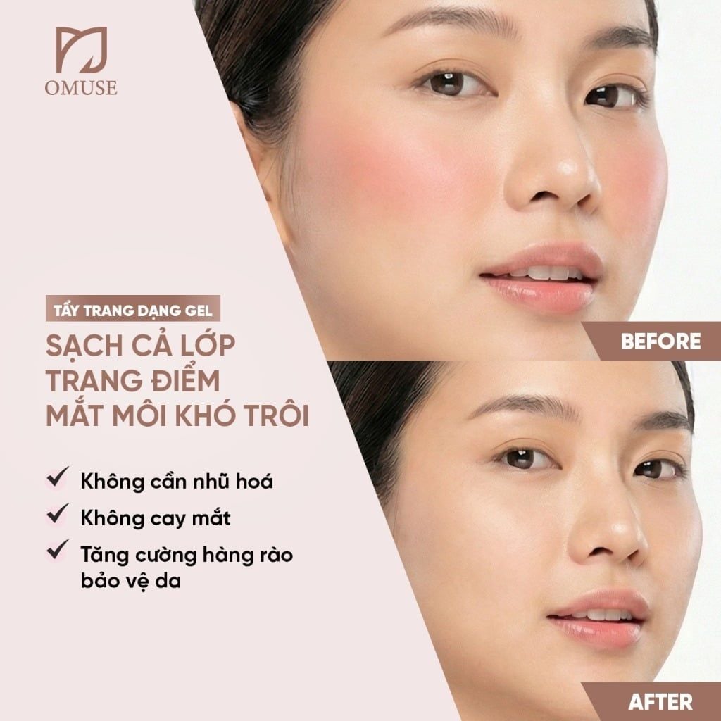 Gel Tẩy Trang Chuyên Sâu Không Cần Nhũ Hóa Giúp Làm Sạch Sâu, Dịu Nhẹ Cho Da ETE BEAUTE Cleansing Gel (150g)