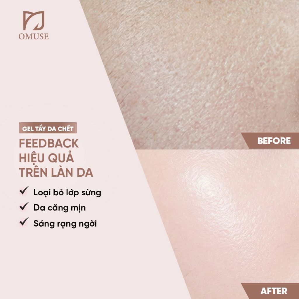 Gel Tẩy Da Chết Mặt Dịu Nhẹ, Loại Bỏ Lớp Sừng & Bã Nhờn, Giúp Da Sáng Mịn, Đều Màu ÉTÉ Peeling Gel 120g
