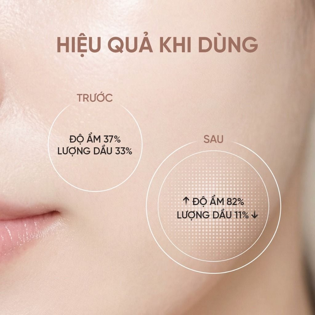 Toner Dưỡng Da Dưỡng Ẩm Da Été Beauté Moist Lotion Chống Lão Hoá Giúp Sáng Da, Se Khít Lỗ Chân Lông 120ml