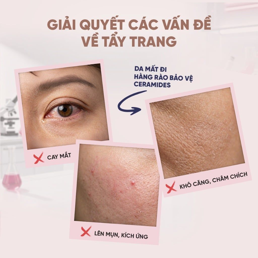 Gel Tẩy Trang Chuyên Sâu Không Cần Nhũ Hóa Giúp Làm Sạch Sâu, Dịu Nhẹ Cho Da ETE BEAUTE Cleansing Gel (150g)