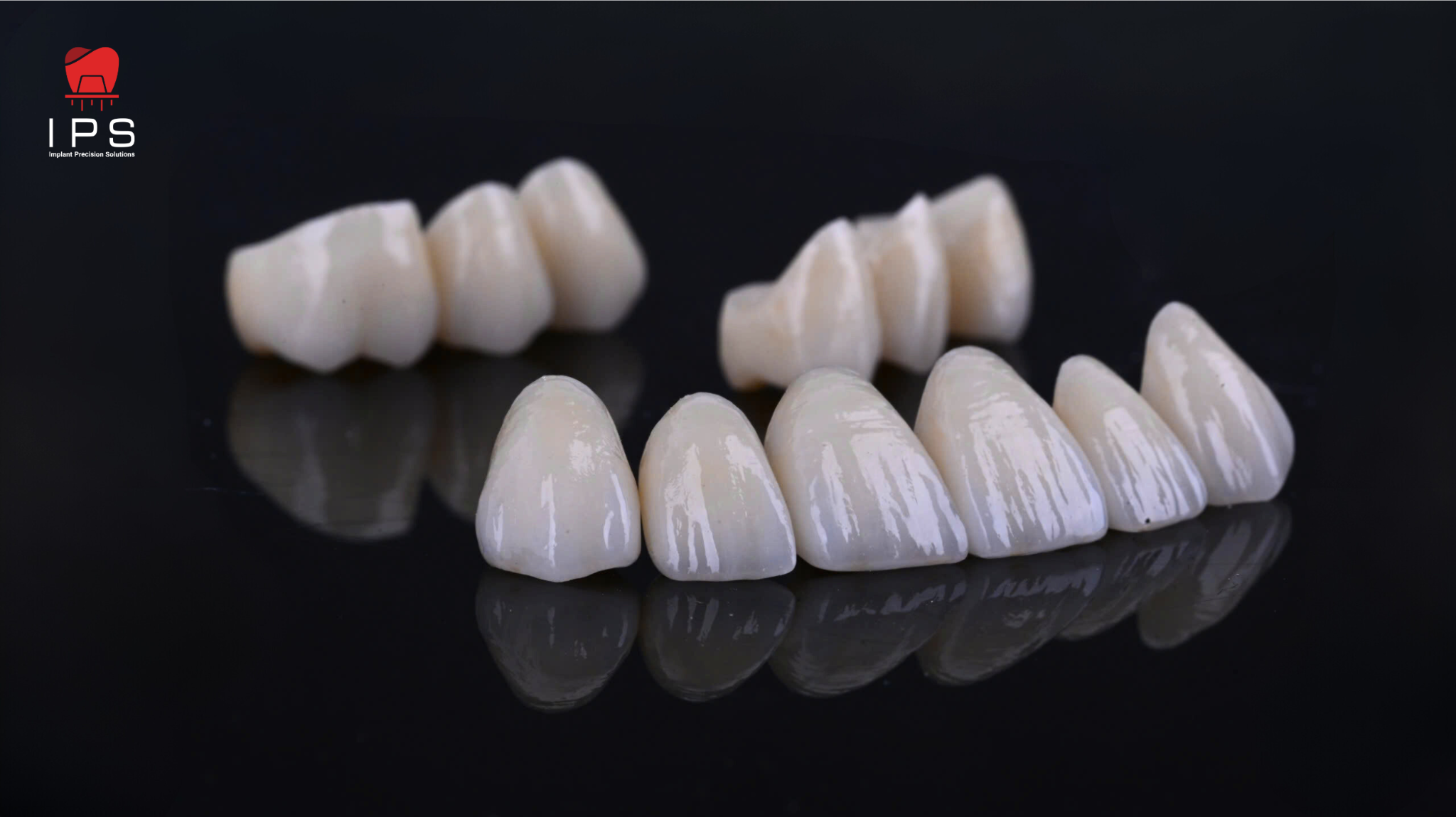  Phục hình thẩm mỹ - Sứ thẩm mỹ 