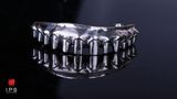  Phục hình thimble toàn hàm all on x 