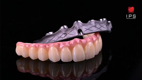  Phục hình toàn hàm hybrid all on x - Zirconia 