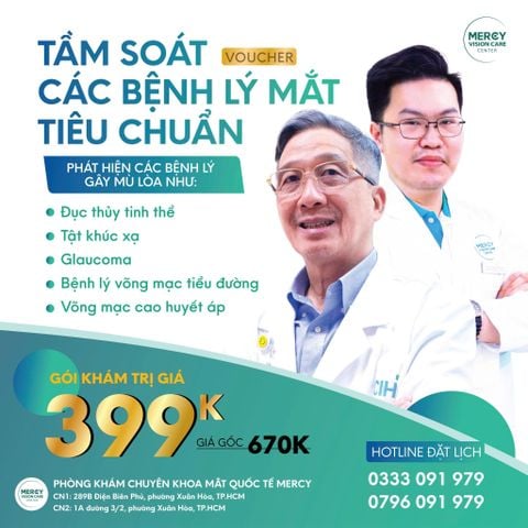 Sản phẩm khuyến mãi