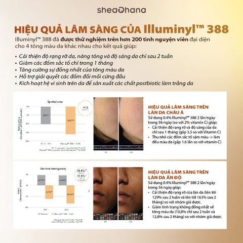 32 PIGM AMPOULE – Tinh chất chuyên sâu làm mờ thâm nám đốm nâu