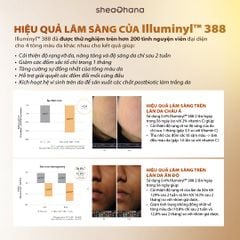 32 PIGM AMPOULE – Tinh chất chuyên sâu làm mờ thâm nám đốm nâu