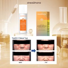 32 PIGM AMPOULE – Tinh chất chuyên sâu làm mờ thâm nám đốm nâu