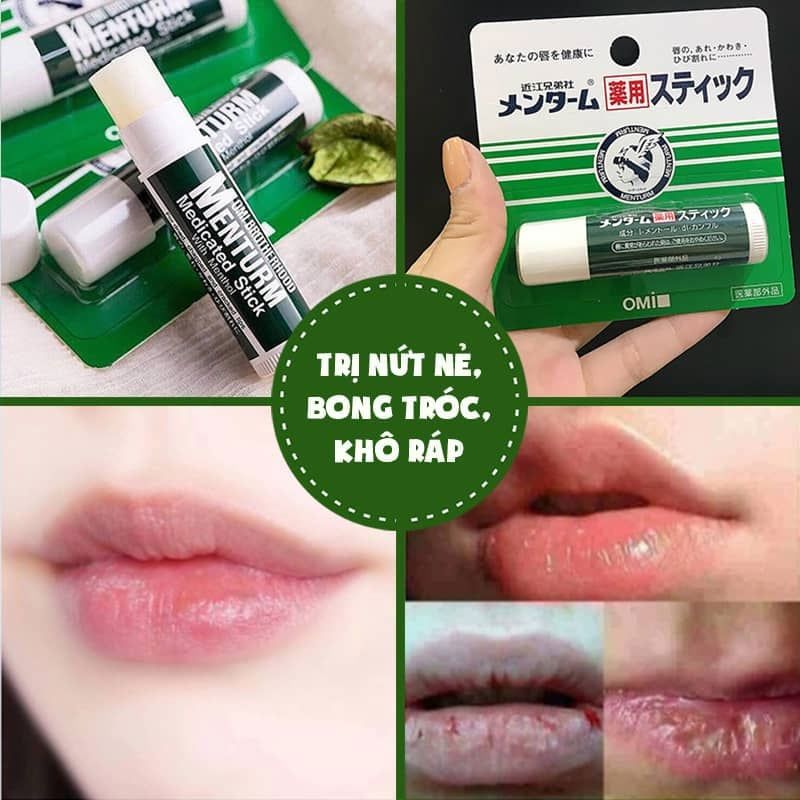 Son dưỡng Omi bạc hà ngừa thâm môi