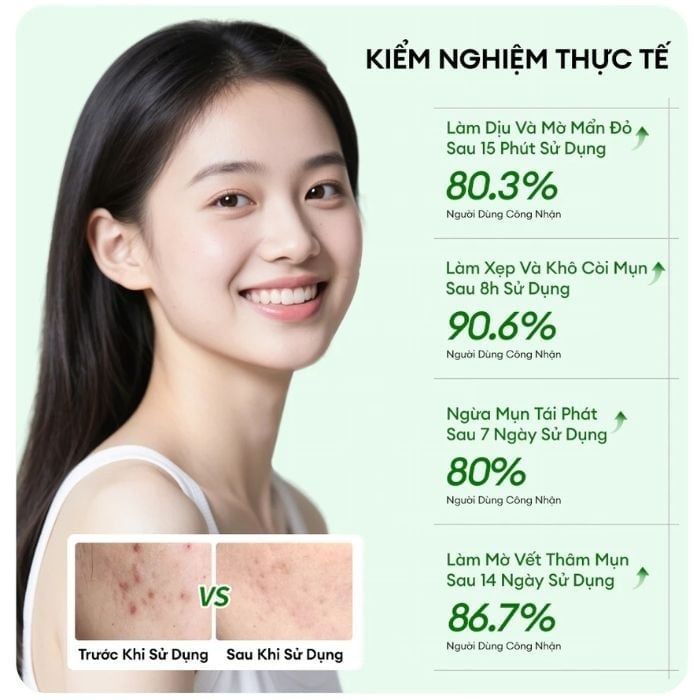 Kem giảm mụn Colorkey luminous Green Tea purifying acne treatment 20g
