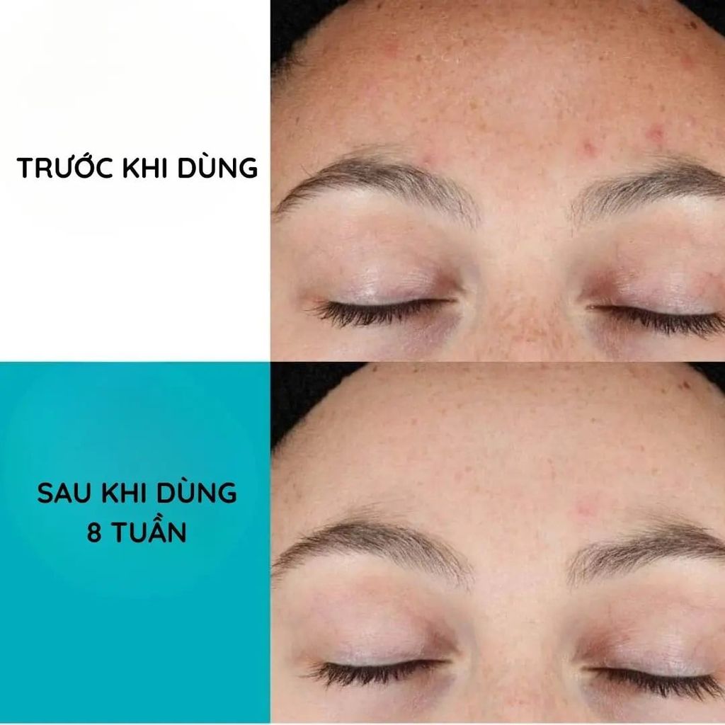 Serum Phục Hồi Da Cerave Retinol Anti - Marques 30ml