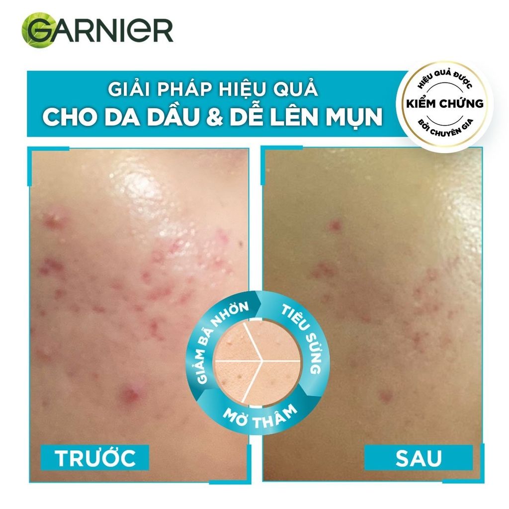 Tinh Chất Cho Da Dầu Mụn Garnier Bright Complete Anti-Acnes Booster Serum