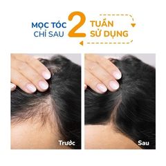 Dầu Gội Hoa Bưởi 250ml – Giảm Gãy Rụng & Hỗ Trợ Mọc Tóc NEO NATURE