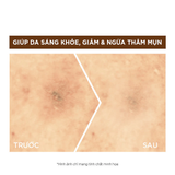  Serum Garnier Bright Complete 10% Pure Vitamin C Night Serum Tăng Cường Sáng Da Mờ Thâm Ban Đêm 30ml 