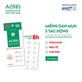  Gel Ngừa Mụn và Giảm Thâm Acnes (Sealing Jell / CLEAR CREAM/ Scar Care / Dán Mụn) 