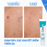  Gel Giảm Mụn Cerave Blemish Control Gel Mờ Thâm, Thu Nhỏ Lỗ Chân Lông 40ml 