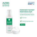  Sữa Rửa Mặt Acnes Kiểm Soát Nhờn,Mụn Acnes Oil Control Cleanser/Creamy Wash/Foaming Wash/Vitamin Cleanser/Gentle 
