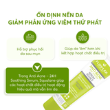  Serum Floslek Anti Acne 24H System Soothing Làm Dịu, Giảm Mụn, Kiềm Dầu, Thu Nhỏ Chân Lông Da Dầu, Hỗn Hợp 50ml 