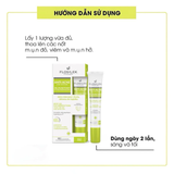  Gel Chấm Mụn Floslek Anti Acne Mụn Sưng, Mờ Thâm, Ngừa Mụn Tái Phát 20ml 