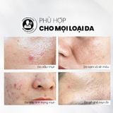  Serum Tẩy Tế Bào Chết Kiểm Soát Mụn, Giảm Viêm Và Giảm Tiết Dầu MD CARE AntiAc Exfo 