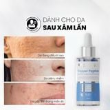  Serum Chống Lão Hóa Copper Peptide Hỗ Trợ Tăng Sinh Collagen, Làm Đầy Sẹo MD CARE 30ml 