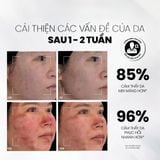 Serum Chống Lão Hóa Copper Peptide Hỗ Trợ Tăng Sinh Collagen, Làm Đầy Sẹo MD CARE 30ml 