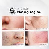  Serum Tẩy Tế Bào Chết Làm Sáng, Mờ Thâm Và Đều Màu Da MD Care Glow Exfo 30ml 