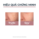  Giảm Thâm Nám Eucerin Spotless Brightening Spot Corrector 5ml - Serum Dạng Bút Chấm, Chàm, Đốm Nâu 