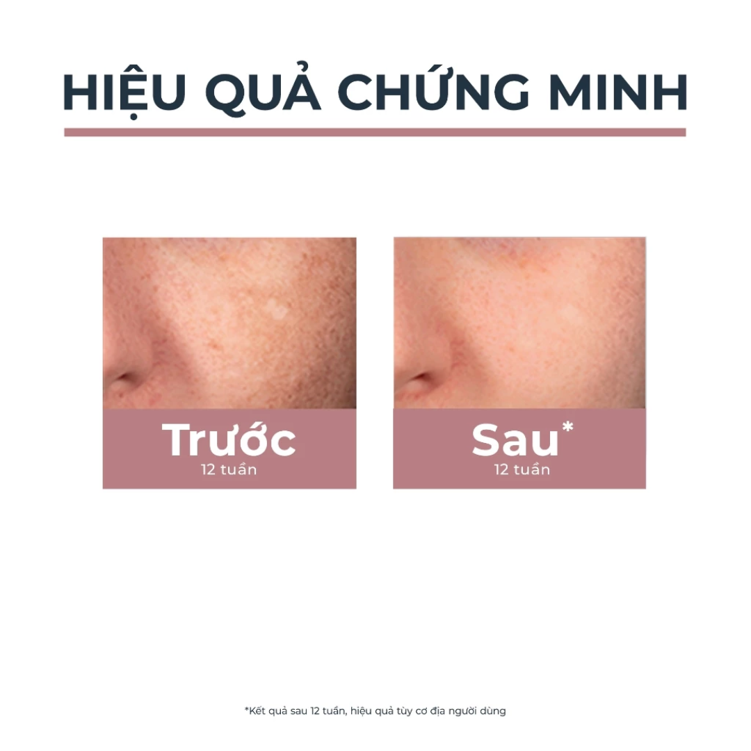  Giảm Thâm Nám Eucerin Spotless Brightening Spot Corrector 5ml - Serum Dạng Bút Chấm, Chàm, Đốm Nâu 