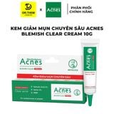  Gel Ngừa Mụn và Giảm Thâm Acnes (Sealing Jell / CLEAR CREAM/ Scar Care / Dán Mụn) 