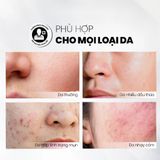  Serum Tẩy Tế Bào Chết Căng Bóng, Cấp Ẩm Và Làm Sáng Da MD Care Mande Exfo 30ml 