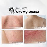  Xịt Tẩy Tế Bào Chết Toàn Thân AHAs & BHA MD CARE Exfoliating Body Spray 100ml 
