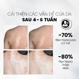  Xịt Tẩy Tế Bào Chết Toàn Thân AHAs & BHA MD CARE Exfoliating Body Spray 100ml 
