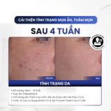  Kem Dưỡng Làm Sáng MD CARE PRO-RETINOL Trẻ Hoá Và Cải Thiện Nếp Nhăn 30ml - Dr Thêm 