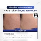  Kem Dưỡng Làm Sáng MD CARE PRO-RETINOL Trẻ Hoá Và Cải Thiện Nếp Nhăn 30ml - Dr Thêm 