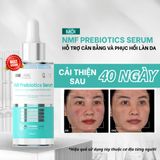  Serum NMF Prebiotics Hỗ Trợ Giảm Đỏ Giảm Sưng Tăng Cường Phục Hồi Bảo Vệ Làn Da MD Care 30ml 